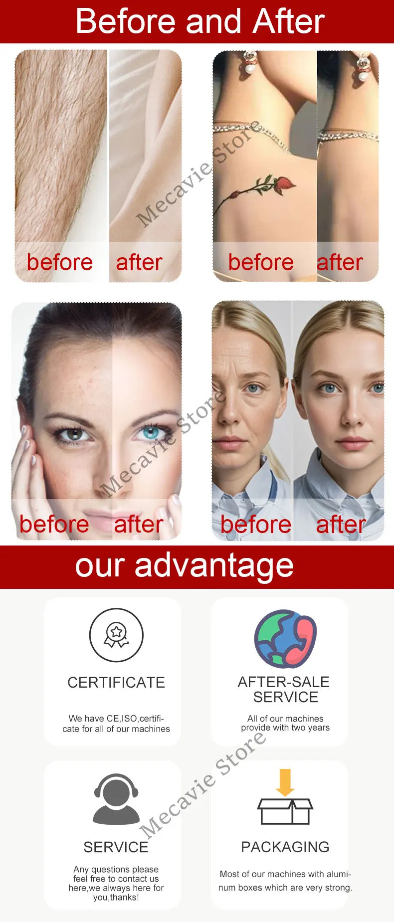 2025 Newest 4 In 1 Diode Laser Pico 808 Carbon Peeling RF Ipl Nd Yag Picosecond Laser Opt Hair Removal Tattoo Removal Machine